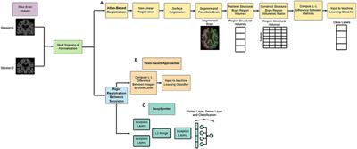 Quantifying Neurodegenerative Progression With DeepSymNet, an End-to-End Data-Driven Approach